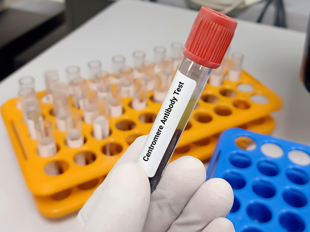 Pruebas de alergias y exámenes de alergias en sangre